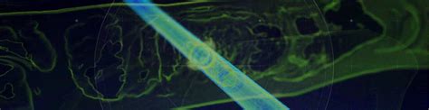 wellwatcher ultra ase|SLB Improves Heavy Oil Recovery with WellWatcher Technology.